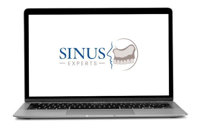 Curso Sinus Experts exibido em um notebook